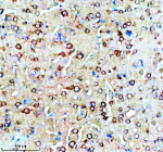 Immunohistochemical staining of SNX16 using anti-SNX16 antibody. SNX16 was detected in a paraffin-embedded section of rat brain tissue. Heat mediated antigen retrieval was performed in EDTA buffer (pH 8.0, epitope retrieval solution). The tissue section was blocked with 10% goat serum. The tissue section was then incubated with 2 ug/ml rabbit anti-SNX16 antibody overnight at 4oC. Peroxidase Conjugated Goat Anti-rabbit IgG was used as secondary antibody and incubated for 30 minutes at 37oC. The tissue section was developed using an HRP secondary and DAB substrate.