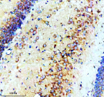 Immunohistochemical staining of SNX16 using anti-SNX16 antibody. SNX16 was detected in a paraffin-embedded section of rat brain tissue. Heat mediated antigen retrieval was performed in EDTA buffer (pH 8.0, epitope retrieval solution). The tissue section was blocked with 10% goat serum. The tissue section was then incubated with 2 ug/ml rabbit anti-SNX16 antibody overnight at 4oC. Peroxidase Conjugated Goat Anti-rabbit IgG was used as secondary antibody and incubated for 30 minutes at 37oC. The tissue section was developed using an HRP secondary and DAB substrate.