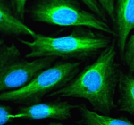 Immunofluorescent staining of SNX16 using anti-SNX16 antibody (green). SNX16 was detected in an immunocytochemical section of U2OS cells. Enzyme antigen retrieval was performed using IHC enzyme antigen retrieval reagent for 15 mins. The cells were blocked with 10% goat serum. And then incubated with 5 ug/ml rabbit anti-SNX16 antibody overnight at 4oC. DyLight 488 Conjugated Goat Anti-Rabbit IgG was used as secondary antibody at 1:500 dilution and incubated for 30 minutes at 37oC. The section was counterstained with DAPI nuclear stain (blue). Visualize using a fluorescence microscope and filter sets appropriate for the label used.