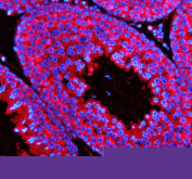 Immunofluorescent staining of STX5 using anti-STX5 antibody (red). STX5 was detected in a paraffin-embedded section of rat testis tissue. Heat mediated antigen retrieval was performed in EDTA buffer (pH 8.0, epitope retrieval solution). The tissue section was blocked with 10% goat serum. The tissue section was then incubated with 5 ug/ml rabbit anti-STX5 antibody overnight at 4oC. Cy3 Conjugated Goat Anti-Rabbit IgG was used as secondary antibody at 1:500 dilution and incubated for 30 minutes at 37oC. The section was counterstained with DAPI nuclear stain (blue). Visualize using a fluorescence microscope and filter sets appropriate for the label used.