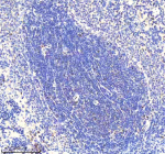 Immunohistochemical staining of RNF111 using anti-RNF111 antibody. RNF111 was detected in a paraffin-embedded section of rat spleen tissue. Heat mediated antigen retrieval was performed in EDTA buffer (pH 8.0, epitope retrieval solution). The tissue section was blocked with 10% goat serum. The tissue section was then incubated with 2 ug/ml rabbit anti-RNF111 antibody overnight at 4oC. Peroxidase Conjugated Goat Anti-rabbit IgG was used as secondary antibody and incubated for 30 minutes at 37oC. The tissue section was developed using an HRP secondary and DAB substrate.