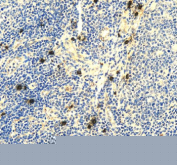 Immunohistochemical staining of RNF111 using anti-RNF111 antibody. RNF111 was detected in a paraffin-embedded section of human tonsil tissue. Heat mediated antigen retrieval was performed in EDTA buffer (pH 8.0, epitope retrieval solution). The tissue section was blocked with 10% goat serum. The tissue section was then incubated with 2 ug/ml rabbit anti-RNF111 antibody overnight at 4oC. Peroxidase Conjugated Goat Anti-rabbit IgG was used as secondary antibody and incubated for 30 minutes at 37oC. The tissue section was developed using an HRP secondary and DAB substrate.