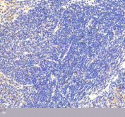Immunohistochemical staining of RNF111 using anti-RNF111 antibody. RNF111 was detected in a paraffin-embedded section of mouse spleen tissue. Heat mediated antigen retrieval was performed in EDTA buffer (pH 8.0, epitope retrieval solution). The tissue section was blocked with 10% goat serum. The tissue section was then incubated with 2 ug/ml rabbit anti-RNF111 antibody overnight at 4oC. Peroxidase Conjugated Goat Anti-rabbit IgG was used as secondary antibody and incubated for 30 minutes at 37oC. The tissue section was developed using an HRP secondary and DAB substrate.