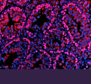 Immunofluorescent staining of PARP11 using anti-PARP11 antibody (red). PARP11 was detected in a paraffin-embedded section of mouse testis tissue. Heat mediated antigen retrieval was performed in EDTA buffer (pH 8.0, epitope retrieval solution). The tissue section was blocked with 10% goat serum. The tissue section was then incubated with 5 ug/ml rabbit anti-PARP11 antibody overnight at 4oC. Cy3 Conjugated Goat Anti-Rabbit IgG was used as secondary antibody at 1:500 dilution and incubated for 30 minutes at 37oC. The section was counterstained with DAPI nuclear stain (blue). Visualize using a fluorescence microscope and filter sets appropriate for the label used.