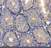 Immunohistochemical staining of PARP11 using anti-PARP11 antibody. PARP11 was detected in a paraffin-embedded section of mouse testis tissue. Heat mediated antigen retrieval was performed in EDTA buffer (pH 8.0, epitope retrieval solution). The tissue section was blocked with 10% goat serum. The tissue section was then incubated with 2 ug/ml rabbit anti-PARP11 antibody overnight at 4oC. Peroxidase Conjugated Goat Anti-rabbit IgG was used as secondary antibody and incubated for 30 minutes at 37oC. The tissue section was developed using an HRP secondary and DAB substrate.