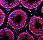 Immunofluorescent staining of PARP11 using anti-PARP11 antibody (red). PARP11 was detected in a paraffin-embedded section of rat testis tissue. Heat mediated antigen retrieval was performed in EDTA buffer (pH 8.0, epitope retrieval solution). The tissue section was blocked with 10% goat serum. The tissue section was then incubated with 5 ug/ml rabbit anti-PARP11 antibody overnight at 4oC. Cy3 Conjugated Goat Anti-Rabbit IgG was used as secondary antibody at 1:500 dilution and incubated for 30 minutes at 37oC. The section was counterstained with DAPI nuclear stain (blue). Visualize using a fluorescence microscope and filter sets appropriate for the label used.
