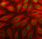 Immunofluorescent staining of PARP11 using anti-PARP11 antibody (green) and anti-Alpha Tubulin antibody (red). PARP11 was detected in an immunocytochemical section of U2OS cells. Enzyme antigen retrieval was performed using IHC enzyme antigen retrieval reagent for 15 mins. The cells were blocked with 10% goat serum. And then incubated with 5 ug/ml rabbit anti-PARP11 antibody and mouse anti-Beta Tubulin antibody overnight at 4oC. DyLight 488 Conjugated Goat Anti-Rabbit IgG and Cy3 Conjugated Goat Anti-Mouse IgG were used as secondary antibody at 1:500 dilution and incubated for 30 minutes at 37oC. Visualize using a fluorescence microscope and filter sets appropriate for the label used.