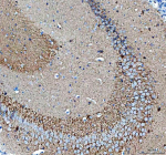 Immunohistochemical staining of SNCB using anti-SNCB antibody. SNCB was detected in a paraffin-embedded section of mouse brain tissue. Heat mediated antigen retrieval was performed in EDTA buffer (pH 8.0, epitope retrieval solution). The tissue section was blocked with 10% goat serum. The tissue section was then incubated with 2 ug/ml rabbit anti-SNCB antibody overnight at 4oC. Peroxidase Conjugated Goat Anti-rabbit IgG was used as secondary antibody and incubated for 30 minutes at 37oC. The tissue section was developed using an HRP secondary and DAB substrate.