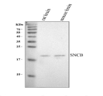 Western blot analysis of SNCB using anti-SNCB antibody. Electrophoresis was performed on a 12% SDS-PAGE gel at 80V (Stacking gel) / 120V (Resolving gel) for 2 hours. Lane 1: rat brain tissue lysates, Lane 2: mouse brain tissue lysates. After electrophoresis, proteins were transferred to a nitrocellulose membrane at 150 mA for 50-90 minutes. Blocked the membrane with 5% non-fat milk/TBS for 1.5 hour at RT. The membrane was incubated with rabbit anti-SNCB antibody at 0.5 ug/ml overnight at 4oC, then washed with TBS-0.1%Tween 3 times with 5 minutes each and probed with a goat anti-rabbit IgG-HRP secondary antibody at a dilution of 1:5000 for 1.5 hour at RT. The signal was developed using an ECL Plus Western Blotting Substrate. SNCB (~14 kDa predicted) was detected as a single band at ~19 kDa, consistent with the known anomalous SDS-PAGE migration of beta-synuclein caused by its acidic and intrinsically disordered structure.