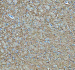 Immunohistochemical staining of SNCB using anti-SNCB antibody. SNCB was detected in a paraffin-embedded section of rat brain tissue. Heat mediated antigen retrieval was performed in EDTA buffer (pH 8.0, epitope retrieval solution). The tissue section was blocked with 10% goat serum. The tissue section was then incubated with 2 ug/ml rabbit anti-SNCB antibody overnight at 4oC. Peroxidase Conjugated Goat Anti-rabbit IgG was used as secondary antibody and incubated for 30 minutes at 37oC. The tissue section was developed using an HRP secondary and DAB substrate.