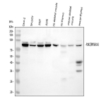 Western blot analysis of RPS6KA3 using anti-RPS6KA3 antibody. Lane 1: human CACO-2 whole cell lysates, Lane 2: human SH-SY5Y whole cell lysates, Lane 3: human 293T whole cell lysates, Lane 4: human whole cell lysates, Lane 5: rat skeletal muscle tissue lysates, Lane 6: rat thymus tissue lysates, Lane 7: mouse skeletal muscle tissue lysates, Lane 8: mouse thymus tissue lysates. After electrophoresis, proteins were transferred to a nitrocellulose membrane at 150 mA for 50-90 minutes. Blocked the membrane with 5% non-fat milk/TBS for 1.5 hour at RT. The membrane was incubated with rabbit anti-RPS6KA3 antibody at 0.25 ug/ml overnight at 4oC, then washed with TBS-0.1%Tween 3 times with 5 minutes each and probed with a goat anti-rabbit IgG-HRP secondary antibody at a dilution of 1:5000 for 1.5 hour at RT. The signal was developed using enhanced chemiluminescent. RPS6KA3/RSK2 (~90 kDa) was detected as a doublet in human samples; the upper, slower-migrating band is consistent with phosphorylation-dependent mobility shifts associated with ERK- and PDK1-mediated activation and Ser386 autophosphorylation.