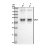Western blot analysis of C1QA using anti-C1QA antibody. Electrophoresis was performed on a 12% SDS-PAGE gel at 80V (Stacking gel) / 120V (Resolving gel) for 2 hours. Lane 1: human HCCT whole cell lysates, Lane 2: human HCCP whole cell lysates. After electrophoresis, proteins were transferred to a nitrocellulose membrane at 150 mA for 50-90 minutes. Blocked the membrane with 5% non-fat milk/TBS for 1.5 hour at RT. The membrane was incubated with rabbit anti-C1QA antibody at 1:500 overnight at 4oC, then washed with TBS-0.1%Tween 3 times with 5 minutes each and probed with a goat anti-rabbit IgG-HRP secondary antibody at a dilution of 1:5000 for 1.5 hour at RT. The signal was developed using an ECL Plus Western Blotting Substrate. A specific band was detected for C1QA at approximately 28 kDa. The expected molecular weight of C1QA is ~28 kDa.