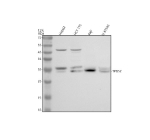 Western blot analysis of TPD52 using anti-TPD52 antibody. Electrophoresis was performed on a 12% SDS-PAGE gel at 80V (Stacking gel) / 120V (Resolving gel) for 2 hours. Lane 1: human HepG2 whole cell lysates, Lane 2: human HCT116 whole cell lysates, Lane 3: human Raji whole cell lysates, Lane 4: human U-87MG whole cell lysates. After electrophoresis, proteins were transferred to a nitrocellulose membrane at 150 mA for 50-90 minutes. Blocked the membrane with 5% non-fat milk/TBS for 1.5 hour at RT. The membrane was incubated with rabbit anti-TPD52 antibody at 0.5 ug/ml overnight at 4oC, then washed with TBS-0.1%Tween 3 times with 5 minutes each and probed with a goat anti-rabbit IgG-HRP secondary antibody at a dilution of 1:5000 for 1.5 hour at RT. The signal was developed using an ECL Plus Western Blotting Substrate. TPD52 (~25 kDa predicted) was detected as a doublet between 25-28 kDa, consistent with phosphorylation-dependent mobility shifts and isoform heterogeneity previously reported for this vesicle-associated protein.