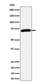 Western blot analysis of Choline Acetyltransferase expression in mouse brain cell lysate using CHAT antibody. Predicted molecular weight ~74 kDa.