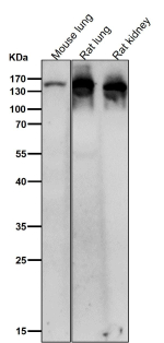 All lanes use the Ceruloplasmin antibody at 1:2K dilution for 1 hour at room temperature. Predicted molecular weight ~130 kDa.
