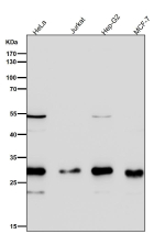 All lanes use the SDHB antibody at 1:3000 dilution for 1 hour at room temperature. Expected molecular weight: 25-32 kDa.