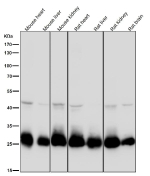 All lanes use the SDHB antibody at 1:3000 dilution for 1 hour at room temperature. Expected molecular weight: 25-32 kDa.