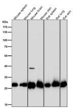 All lanes use the SDHB antibody at 1:3W dilution for 1 hour at room temperature.