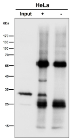 Immunoprecipitation analysis using the SDHB antibody at 1:50 dilution. Western blot performed at 1:1000 dilution. Expected molecular weight: 25-32 kDa.