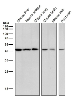 All lanes use the CABP1 antibody at 1:3K dilution for 1 hour at room temperature. Predicted molecular weight ~40 kDa.
