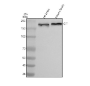 Western blot analysis of CIT using anti-CIT antibody. Lane 1: rat brain tissue lysates, Lane 2: mouse brain tissue lysates. After electrophoresis, proteins were transferred to a nitrocellulose membrane at 150 mA for 50-90 minutes. Blocked the membrane with 5% non-fat milk/TBS for 1.5 hour at RT. The membrane was incubated with rabbit anti-CIT antibody at 0.5 ug/ml overnight at 4oC, then washed with TBS-0.1%Tween 3 times with 5 minutes each and probed with a goat anti-rabbit IgG-HRP secondary antibody at a dilution of 1:5000 for 1.5 hour at RT. The signal was developed using enhanced chemiluminescent. A specific band was detected for CIT at approximately 231 kDa. The expected molecular weight of CIT is ~231 kDa.