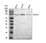 Western blot analysis of PDE8A using anti-PDE8A antibody. Lane 1: human RT4 whole cell lysates, Lane 2: human whole cell lysates, Lane 3: human Hela whole cell lysates. After electrophoresis, proteins were transferred to a nitrocellulose membrane at 150 mA for 50-90 minutes. Blocked the membrane with 5% non-fat milk/TBS for 1.5 hour at RT. The membrane was incubated with rabbit anti-PDE8A antibody at 0.5 ug/ml overnight at 4oC, then washed with TBS-0.1%Tween 3 times with 5 minutes each and probed with a goat anti-rabbit IgG-HRP secondary antibody at a dilution of 1:5000 for 1.5 hour at RT. The signal was developed using enhanced chemiluminescent. A specific band was detected for PDE8A at approximately 93 kDa. The expected molecular weight of PDE8A is ~93 kDa.