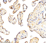 Immunohistochemical staining of BCAP31 using anti-BCAP31 antibody. BCAP31 was detected in a paraffin-embedded section of human placenta tissue. Heat mediated antigen retrieval was performed in EDTA buffer (pH 8.0, epitope retrieval solution). The tissue section was blocked with 10% goat serum. The tissue section was then incubated with 2 ug/ml rabbit anti-BCAP31 antibody overnight at 4oC. Peroxidase Conjugated Goat Anti-rabbit IgG was used as secondary antibody and incubated for 30 minutes at 37oC. The tissue section was developed using an HRP secondary and DAB substrate.