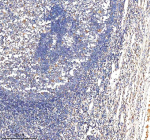 Immunohistochemical staining of BCAP31 using anti-BCAP31 antibody. BCAP31 was detected in a paraffin-embedded section of human tonsil tissue. Heat mediated antigen retrieval was performed in EDTA buffer (pH 8.0, epitope retrieval solution). The tissue section was blocked with 10% goat serum. The tissue section was then incubated with 2 ug/ml rabbit anti-BCAP31 antibody overnight at 4oC. Peroxidase Conjugated Goat Anti-rabbit IgG was used as secondary antibody and incubated for 30 minutes at 37oC. The tissue section was developed using an HRP secondary and DAB substrate.