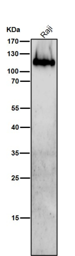 ITGB7 antibody at 1:2000 dilution for 1 hour at room temperature used to test human Raji cell lysate. ITGB7 (~87 kDa predicted) was detected at ~120-130 kDa, consistent with the mature, heavily N-glycosylated form of the Beta-7 integrin subunit commonly observed in lymphoid and epithelial tissues.