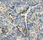 Immunohistochemical staining of ITGB7 using anti-ITGB7 antibody. ITGB7 was detected in a paraffin-embedded section of mouse spleen tissue. Heat mediated antigen retrieval was performed in EDTA buffer (pH 8.0, epitope retrieval solution). The tissue section was blocked with 10% goat serum. The tissue section was then incubated with 1:50 rabbit anti-ITGB7 antibody overnight at 4oC. Peroxidase Conjugated Goat Anti-rabbit IgG was used as secondary antibody and incubated for 30 minutes at 37oC. The tissue section was developed using an HRP secondary and DAB substrate.