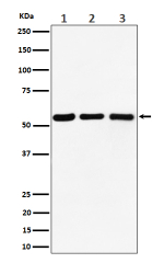 Western blot analysis of PRPF4 expression in (1) Raji cell lysate; (2) RAW 264.7 cell lysate; (3) C6 cell lysate.