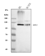 Western blot analysis of RB1 using anti-RB1 antibody. Electrophoresis was performed on a 10% SDS-PAGE gel at 80V (Stacking gel) / 120V (Resolving gel) for 2 hours. Lane 1: human HEL whole cell lysates, Lane 2: human SH-SY5Y whole cell lysates. After electrophoresis, proteins were transferred to a nitrocellulose membrane at 150 mA for 50-90 minutes. Blocked the membrane with 5% non-fat milk/TBS for 1.5 hour at RT. The membrane was incubated with rabbit anti-RB1 antibody at 1:1000 overnight at 4oC, then washed with TBS-0.1%Tween 3 times with 5 minutes each and probed with a goat anti-rabbit IgG-HRP secondary antibody at a dilution of 1:5000 for 1.5 hour at RT. The signal was developed using an ECL Plus Western Blotting Substrate. RB1 (~106 kDa predicted) was detected at ~110-120 kDa, consistent with the hyperphosphorylated form of the retinoblastoma protein that exhibits slower SDS-PAGE migration due to extensive phosphorylation and its acidic C-terminal region