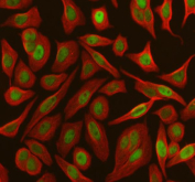 Immunofluorescent staining of FFPE human A549 cells with RB1 antibody (green) and Beta Tubulin mAb (red). HIER: steam section in pH6 citrate buffer for 20 min.