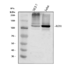 Western blot analysis of RB1 using anti-RB1 antibody. Electrophoresis was performed on a 8% SDS-PAGE gel at 80V (Stacking gel) / 120V (Resolving gel) for 2 hours. Lane 1: human MCF-7 whole cell lysates, Lane 2: human Jurkat whole cell lysates. After electrophoresis, proteins were transferred to a nitrocellulose membrane at 150 mA for 50-90 minutes. Blocked the membrane with 5% non-fat milk/TBS for 1.5 hour at RT. The membrane was incubated with rabbit anti-RB1 antibody at 0.5 ug/ml overnight at 4oC, then washed with TBS-0.1%Tween 3 times with 5 minutes each and probed with a goat anti-rabbit IgG-HRP secondary antibody at a dilution of 1:5000 for 1.5 hour at RT. The signal was developed using an ECL Plus Western Blotting Substrate. RB1 (~106 kDa predicted) was detected at ~110-120 kDa, consistent with the hyperphosphorylated form of the retinoblastoma protein that exhibits slower SDS-PAGE migration due to extensive phosphorylation and its acidic C-terminal region