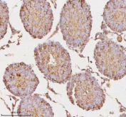 Immunohistochemical staining of MICALL1 using anti-MICALL1 antibody. MICALL1 was detected in a paraffin-embedded section of rat testis tissue. Heat mediated antigen retrieval was performed in EDTA buffer (pH 8.0, epitope retrieval solution). The tissue section was blocked with 10% goat serum. The tissue section was then incubated with 2 ug/ml rabbit anti-MICALL1 antibody overnight at 4oC. Peroxidase Conjugated Goat Anti-rabbit IgG was used as secondary antibody and incubated for 30 minutes at 37oC. The tissue section was developed using an HRP secondary and DAB substrate.