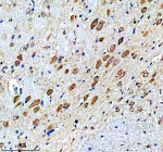 Immunohistochemical staining of MSI2 using anti-MSI2 antibody. MSI2 was detected in a paraffin-embedded section of rat brain tissue. Heat mediated antigen retrieval was performed in EDTA buffer (pH 8.0, epitope retrieval solution). The tissue section was blocked with 10% goat serum. The tissue section was then incubated with 2 ug/ml rabbit anti-MSI2 antibody overnight at 4oC. Peroxidase Conjugated Goat Anti-rabbit IgG was used as secondary antibody and incubated for 30 minutes at 37oC. The tissue section was developed using an HRP secondary and DAB substrate.