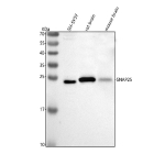 Western blot analysis of SNAP25 using anti-SNAP25 antibody. Lane 1: human SH-SY5Y whole cell lysates, Lane 2: rat brain tissue lysates, Lane 3: mouse brain tissue lysates. After electrophoresis, proteins were transferred to a nitrocellulose membrane at 150 mA for 50-90 minutes. Blocked the membrane with 5% non-fat milk/TBS for 1.5 hour at RT. The membrane was incubated with rabbit anti-SNAP25 antibody at 0.5 ug/ml overnight at 4oC, then washed with TBS-0.1%Tween 3 times with 5 minutes each and probed with a goat anti-rabbit IgG-HRP secondary antibody at a dilution of 1:5000 for 1.5 hour at RT. The signal was developed using enhanced chemiluminescent. The expected molecular weight of SNAP25 is 24-25 kDa.