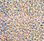 Immunohistochemical staining of MFSD2A using anti-MFSD2A antibody. MFSD2A was detected in a paraffin-embedded section of human liver tissue. Heat mediated antigen retrieval was performed in EDTA buffer (pH 8.0, epitope retrieval solution). The tissue section was blocked with 10% goat serum. The tissue section was then incubated with 2 ug/ml rabbit anti-MFSD2A antibody overnight at 4oC. Peroxidase Conjugated Goat Anti-rabbit IgG was used as secondary antibody and incubated for 30 minutes at 37oC. The tissue section was developed using an HRP secondary and DAB substrate.