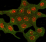Immunofluorescent staining of NUP62 using anti-NUP62 antibody (red) and anti-Beta Tubulin antibody (green). NUP62 was detected in immunocytochemical section of U2OS cell. Enzyme antigen retrieval was performed using IHC enzyme antigen retrieval reagent for 15 mins. The cells were blocked with 10% goat serum. And then incubated with 5 ug/ml rabbit anti-NUP62 antibody and mouse anti-Beta Tubulin antibody overnight at 4oC. Cy3 Conjugated Goat Anti-Rabbit IgG and DyLight 488 Conjugated Goat Anti-Mouse IgG were used as secondary antibody at 1:500 dilution and incubated for 30 minutes at 37oC. Visualize using a fluorescence microscope and filter sets appropriate for the label used.