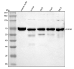 Western blot analysis of NUP62 using anti-NUP62 antibody. Lane 1: mouse testis tissue lysates, Lane 2: human Jurkat whole cell lysates, Lane 3: human 293T whole cell lysates, Lane 4: human Hela whole cell lysates, Lane 5: human PC-3 whole cell lysates. After electrophoresis, proteins were transferred to a nitrocellulose membrane at 150 mA for 50-90 minutes. Blocked the membrane with 5% non-fat milk/TBS for 1.5 hour at RT. The membrane was incubated with rabbit anti-NUP62 antibody at 0.5 ug/ml overnight at 4oC, then washed with TBS-0.1%Tween 3 times with 5 minutes each and probed with a goat anti-rabbit IgG-HRP secondary antibody at a dilution of 1:5000 for 1.5 hour at RT. The signal was developed using enhanced chemiluminescent. Western blot of indicated lysates probed with anti-NUP62. A strong band is detected at ~69 kDa in human cell lines, higher than the calculated ~53 kDa and consistent with the known slower SDS-PAGE migration of NUP62. Mouse testis shows a ~69 kDa doublet, likely reflecting isoform and post-translational modification heterogeneity.