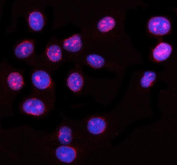 Immunofluorescent staining of NUP62 using anti-NUP62 antibody (red). NUP62 was detected in an immunocytochemical section of U2OS cells. Enzyme antigen retrieval was performed using IHC enzyme antigen retrieval reagent for 15 mins. The cells were blocked with 10% goat serum. And then incubated with 5 ug/ml rabbit anti-NUP62 antibody overnight at 4oC. Cy3 Conjugated Goat Anti-Rabbit IgG was used as secondary antibody at 1:500 dilution and incubated for 30 minutes at 37oC. The section was counterstained with DAPI nuclear stain (blue). Visualize using a fluorescence microscope and filter sets appropriate for the label used.