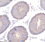 Immunohistochemical staining of POC1A using anti-POC1A antibody. POC1A was detected in a paraffin-embedded section of rat testis tissue. Heat mediated antigen retrieval was performed in EDTA buffer (pH 8.0, epitope retrieval solution). The tissue section was blocked with 10% goat serum. The tissue section was then incubated with 2 ug/ml rabbit anti-POC1A antibody overnight at 4oC. Peroxidase Conjugated Goat Anti-rabbit IgG was used as secondary antibody and incubated for 30 minutes at 37oC. The tissue section was developed using an HRP secondary and DAB substrate.