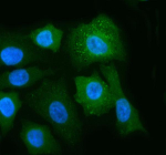 Immunofluorescent staining of POC1A using anti-POC1A antibody (green). POC1A was detected in an immunocytochemical section of cells. Enzyme antigen retrieval was performed using IHC enzyme antigen retrieval reagent for 15 mins. The cells were blocked with 10% goat serum. And then incubated with 5 ug/ml rabbit anti-POC1A antibody overnight at 4oC. DyLight 488 Conjugated Goat Anti-Rabbit IgG was used as secondary antibody at 1:500 dilution and incubated for 30 minutes at 37oC. The section was counterstained with DAPI nuclear stain (blue). Visualize using a fluorescence microscope and filter sets appropriate for the label used.