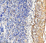 Immunohistochemical staining of RTRAF using anti-RTRAF antibody. RTRAF was detected in a paraffin-embedded section of human tonsil tissue. Heat mediated antigen retrieval was performed in EDTA buffer (pH 8.0, epitope retrieval solution). The tissue section was blocked with 10% goat serum. The tissue section was then incubated with 2 ug/ml rabbit anti-RTRAF antibody overnight at 4oC. Peroxidase Conjugated Goat Anti-rabbit IgG was used as secondary antibody and incubated for 30 minutes at 37oC. The tissue section was developed using an HRP secondary and DAB substrate.