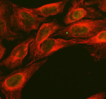 Immunofluorescent staining of RTRAF using anti-RTRAF antibody (green) and anti-Beta Tubulin antibody (red). RTRAF was detected in an immunocytochemical section of U2OS cells. Enzyme antigen retrieval was performed using IHC enzyme antigen retrieval reagent for 15 mins. The cells were blocked with 10% goat serum. And then incubated with 5 ug/ml rabbit anti-RTRAF antibody and mouse anti-Beta Tubulin antibody overnight at 4oC. DyLight 488 Conjugated Goat Anti-Rabbit IgG and DyLight?594 Conjugated Goat Anti-Mouse IgG were used as secondary antibody at 1:500 dilution and incubated for 30 minutes at 37oC. Visualize using a fluorescence microscope and filter sets appropriate for the label used.
