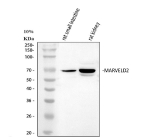 Western blot analysis of MARVELD2 using anti-MARVELD2 antibody. Lane 1: rat small intestine tissue lysates, Lane 2: rat kidney tissue lysates. After electrophoresis, proteins were transferred to a nitrocellulose membrane at 150 mA for 50-90 minutes. Blocked the membrane with 5% non-fat milk/TBS for 1.5 hour at RT. The membrane was incubated with rabbit anti-MARVELD2 antibody at 0.5 ug/ml overnight at 4oC, then washed with TBS-0.1%Tween 3 times with 5 minutes each and probed with a goat anti-rabbit IgG-HRP secondary antibody at a dilution of 1:5000 for 1.5 hour at RT. The signal was developed using enhanced chemiluminescent. A specific band was detected for MARVELD2 at approximately 64 kDa. The expected molecular weight of MARVELD2 is ~64 kDa.