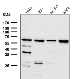 All lanes use the CDC73 antibody at 1:1K dilution for 1 hour at room temperature. Predicted molecular weight ~61 kDa.