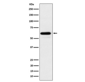 Western blot analysis of HRPT2/CDC73 expression in 293T cell lysate using CDC73 antibody. Predicted molecular weight ~61 kDa.