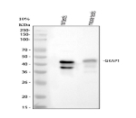Western blot analysis of GKAP1 using anti-GKAP1 antibody. Lane 1: rat testis tissue lysates, Lane 2: mouse testis tissue lysates. After electrophoresis, proteins were transferred to a nitrocellulose membrane at 150 mA for 50-90 minutes. Blocked the membrane with 5% non-fat milk/TBS for 1.5 hour at RT. The membrane was incubated with rabbit anti-GKAP1 antibody at 0.5 ug/ml overnight at 4oC, then washed with TBS-0.1%Tween 3 times with 5 minutes each and probed with a goat anti-rabbit IgG-HRP secondary antibody at a dilution of 1:5000 for 1.5 hour at RT. The signal was developed using enhanced chemiluminescent. Western blot analysis of rat and mouse testis lysates probed with anti-GKAP1 shows a major band at the expected ~46 kDa full-length protein and a lower ~38â40 kDa band corresponding to a truncated GKAP1 isoform expressed in testis.