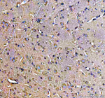 Immunohistochemical staining of SOS1 using anti-SOS1 antibody. SOS1 was detected in a paraffin-embedded section of mouse cerebellum tissue. Heat mediated antigen retrieval was performed in EDTA buffer (pH 8.0, epitope retrieval solution). The tissue section was blocked with 10% goat serum. The tissue section was then incubated with 2 ug/ml rabbit anti-SOS1 antibody overnight at 4oC. Peroxidase Conjugated Goat Anti-rabbit IgG was used as secondary antibody and incubated for 30 minutes at 37oC. The tissue section was developed using an HRP secondary and DAB substrate.